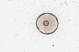 Variations : cartes bulles